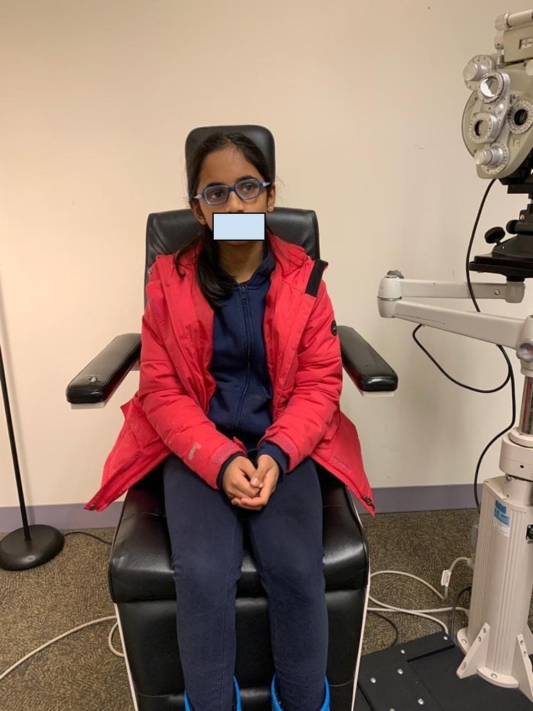 Patient wearing prism glasses at two-year follow-up