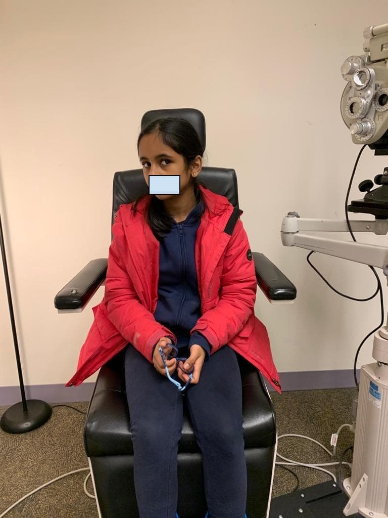Patient demonstrating abnormal head position before wearing prism glasses